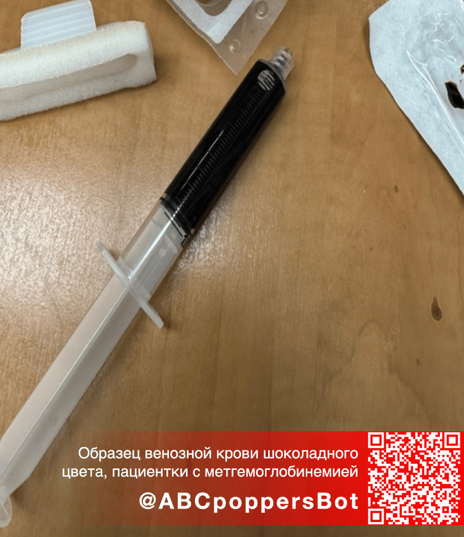 Если принять попперс внутрь в Воронеже это вызывает метгемоглобинемию. Смертельное состояние Если принять попперс внутрь в Воронеже это вызывает метгемоглобинемию. Смертельное состояние